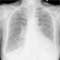 Radiologie Quiz 46